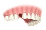 image2-imgs