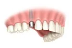 image3-imgs
